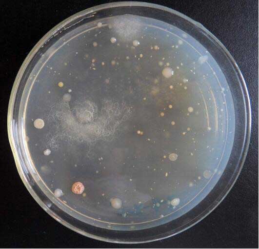 爱博体育冻干机：微生物菌种如何真空冷冻干燥保存